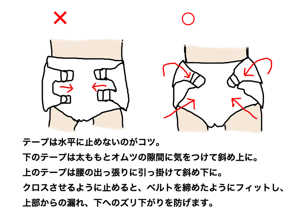 テープ止めのコツ